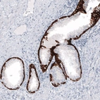 Immunohistochemical staining of human prostate shows strong cytoplasmic positivity in glandular cells.