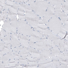 Immunohistochemical staining of human skeletal muscle shows no positivity in myocytes as expected.