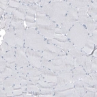 Immunohistochemical staining of human skeletal muscle shows no positivity in myocytes as expected.