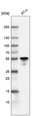 Western blot analysis in human cell line RT-4.