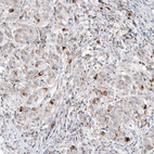 Anti-SCGB2A2 Antibody