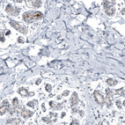Anti-SCGB2A2 Antibody