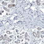 Immunohistochemical staining of human breast shows moderate positivity in secretion.