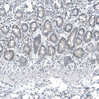 Immunohistochemical staining of human duodenum shows no positivity in glandular cells as expected.