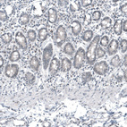 Anti-SCGB2A2 Antibody