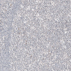 Immunohistochemical staining of human tonsil shows no positivity in exocrine glandular cells as expected.