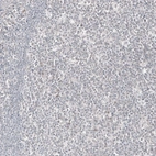 Immunohistochemical staining of human tonsil shows no positivity in exocrine glandular cells as expected.