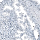 Immunohistochemical staining of human prostate shows no positivity in glandular cells as expected.