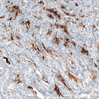 Anti-MUC5AC Antibody