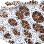 Anti-MUC2 Antibody