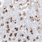 Immunohistochemical staining of human duodenum shows strong positivity in mucus in glandular cells.