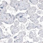 Immunohistochemical staining of human placenta shows no positivity in trophoblastic cells as expected.