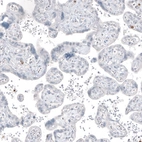 Immunohistochemical staining of human placenta shows no positivity in trophoblastic cells as expected.