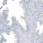 Immunohistochemical staining of human prostate shows no positivity in glandular cells as expected.