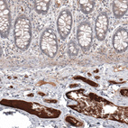 Anti-SAA1 Antibody