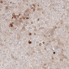 Anti-SAA1 Antibody