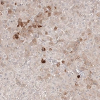 Immunohistochemical staining of human liver shows weak to moderate cytoplasmic positivity in hepatocytes.