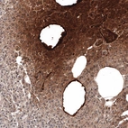 Immunohistochemical staining of human pancreas shows strong positivity in plasma.