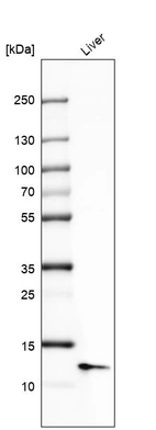 Western blot analysis in human liver tissue.