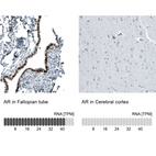 Anti-AR Antibody