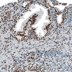 Immunohistochemical staining of human prostate shows strong nuclear positivity in glandular cells.