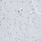 Immunohistochemical staining of human cerebral cortex shows no positivity in neurons as expected.
