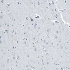 Anti-AR Antibody