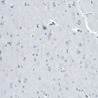 Immunohistochemical staining of human cerebral cortex shows no positivity in neurons as expected.