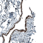 Immunohistochemical staining of human Fallopian tube shows strong nuclear positivity in glandular cells.
