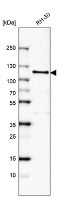 Western blot analysis in human cell line RH-30.