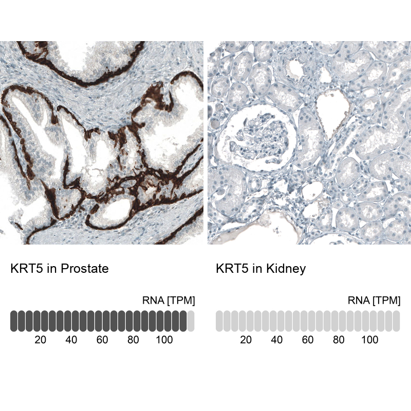 Anti-KRT5 Antibody