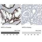 Anti-KRT5 Antibody