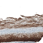 Immunohistochemical staining of human cervix shows moderate to strong cytoplasmic positivity in squamous epithelial cells.