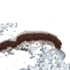 Immunohistochemical staining of human skin shows strong cytoplasmic positivity in squamous epithelial cells.