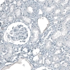 Immunohistochemical staining of human kidney shows no positivity in cells in tubules as expected.