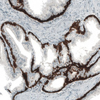 Immunohistochemical staining of human prostate shows strong cytoplasmic positivity in glandular cells.