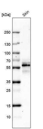 Western blot analysis in human skin tissue.
