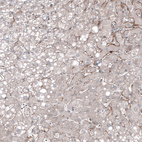 Anti-FOLH1 Antibody