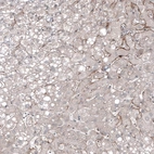 Immunohistochemical staining of human liver shows weak membranous positivity in hepatocytes.