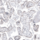 Anti-FOLH1 Antibody