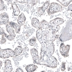 Immunohistochemical staining of human placenta shows no positivity in trophoblastic cells as expected.
