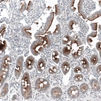 Immunohistochemical staining of human duodenum shows strong membranous positivity in glandular cells.