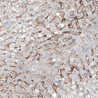 Immunohistochemical staining of human liver shows moderate membranous positivity in hepatocytes.