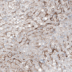 Anti-FOLH1 Antibody