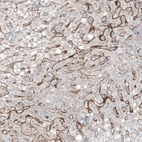 Immunohistochemical staining of human liver shows moderate membranous positivity in hepatocytes.