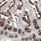Immunohistochemical staining of human duodenum shows strong membranous positivity in glandular cells.