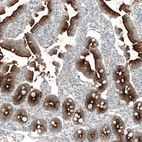 Immunohistochemical staining of human duodenum shows strong membranous positivity in glandular cells.
