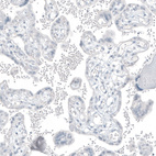 Immunohistochemical staining of human placenta shows no positivity in trophoblastic cells as expected.