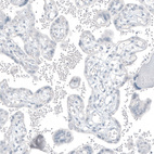 Anti-FOLH1 Antibody