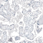 Immunohistochemical staining of human placenta shows no positivity in trophoblastic cells as expected.